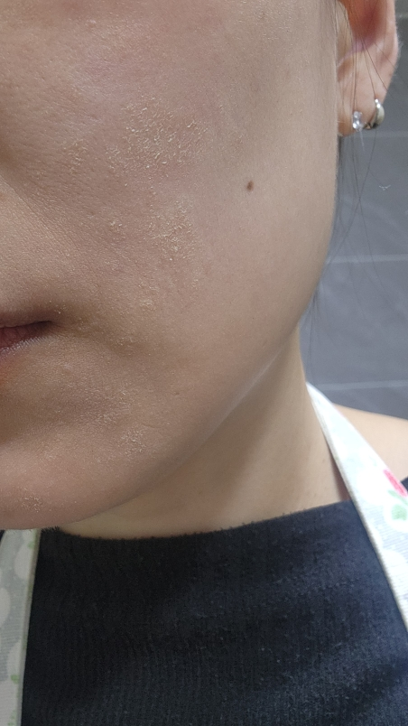 더마팩토리 (DERMAFACTORY) 레티날 300ppm 크림 review image