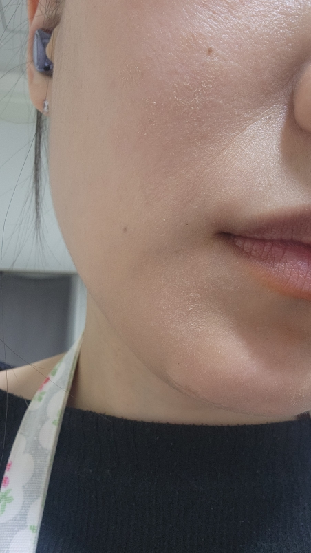 더마팩토리 (DERMAFACTORY) 레티날 300ppm 크림 review image