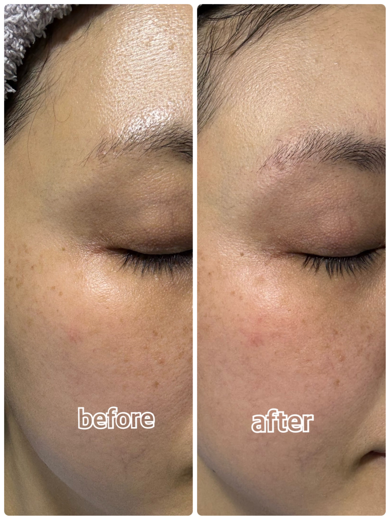 海带安瓶清洁泡沫的真实用户使用照片