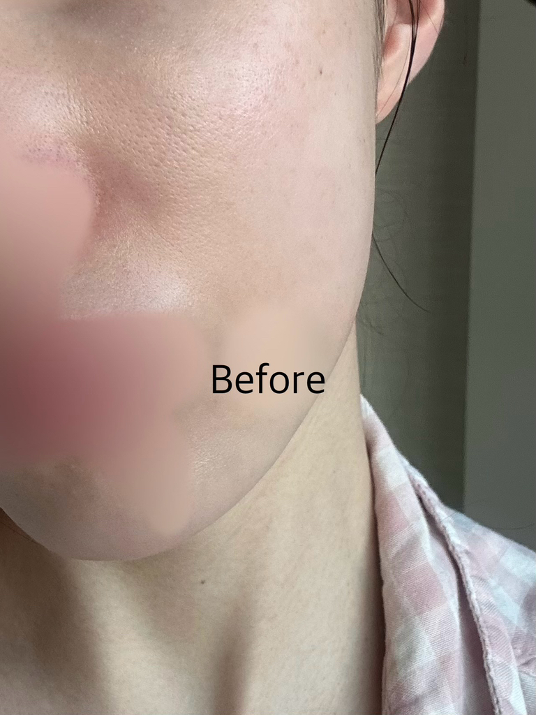 닥터나인틴 (Dr.nineteen) 포어엑스좀 레디알엔 엑소좀 앰플 review image