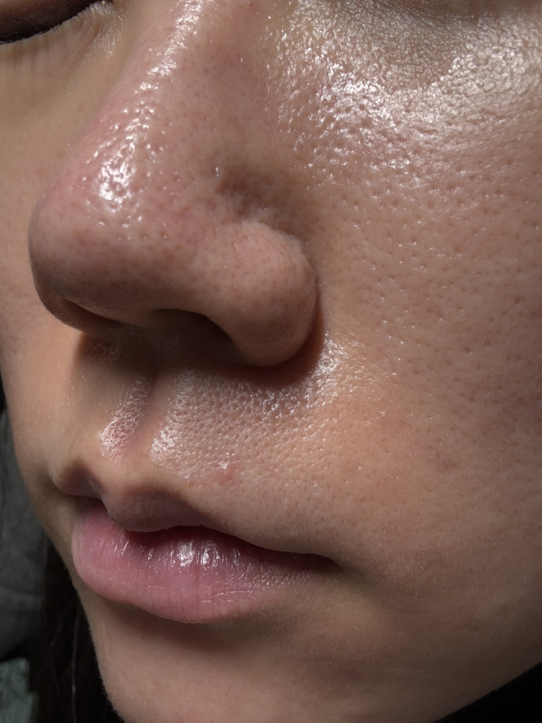 닥터나인틴 (Dr.nineteen) 포어엑스좀 레디알엔 엑소좀 앰플 review image