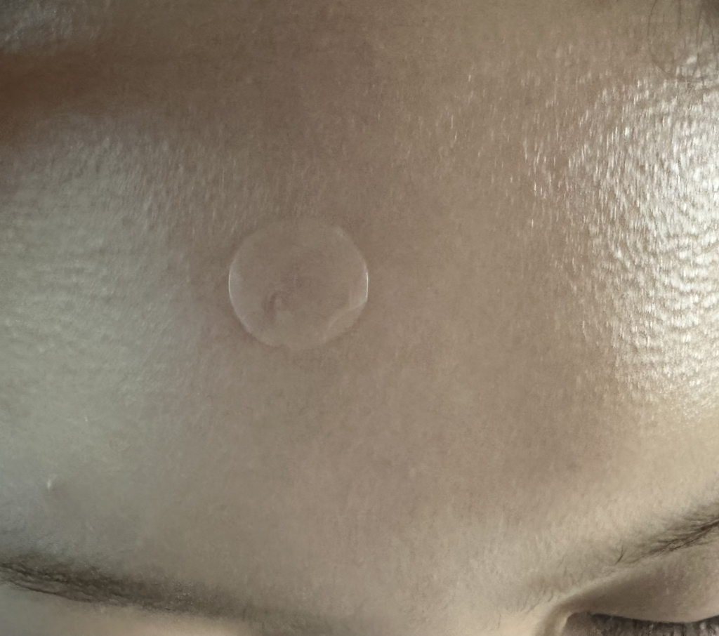 Dr.Oracle TurpinArc™ Spot Patch review image