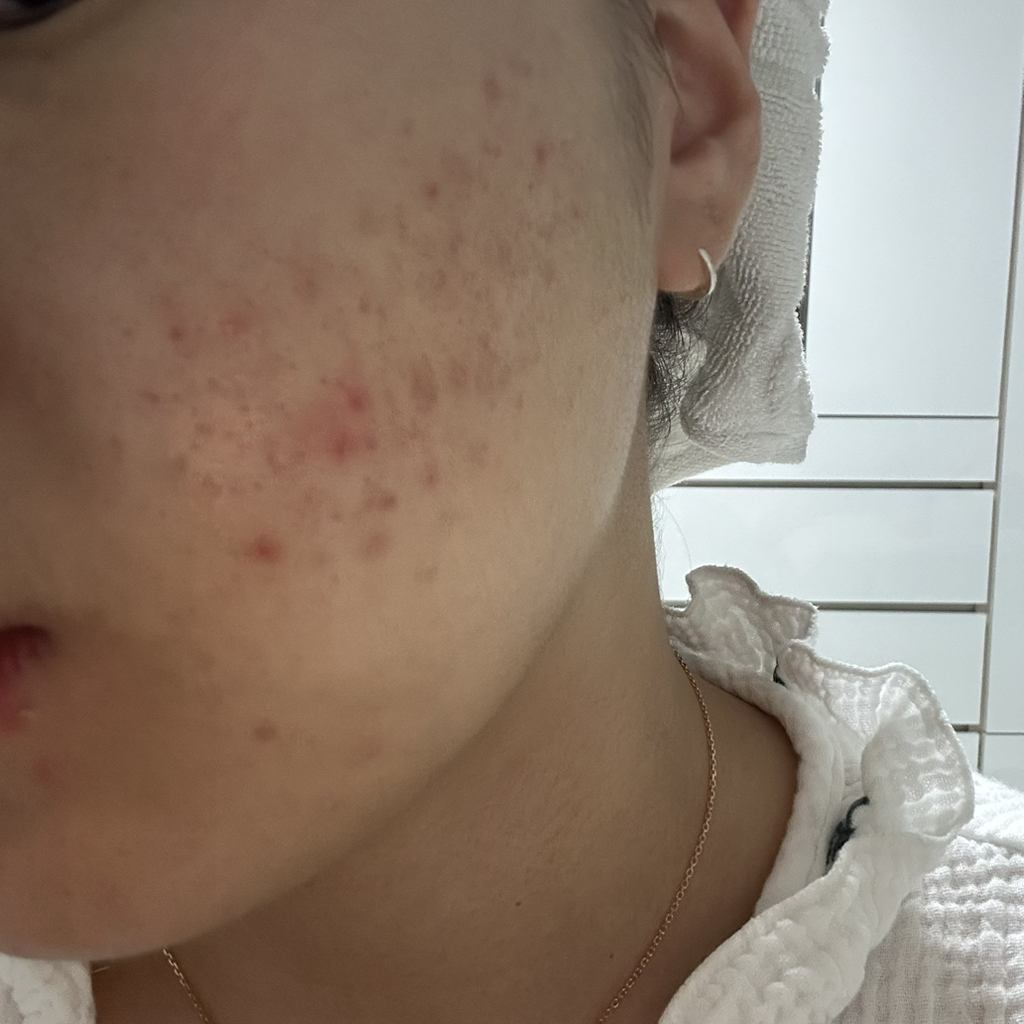 루아센시아 (Luassencia) 메디센스 캐비어 PDRN 크림 review image