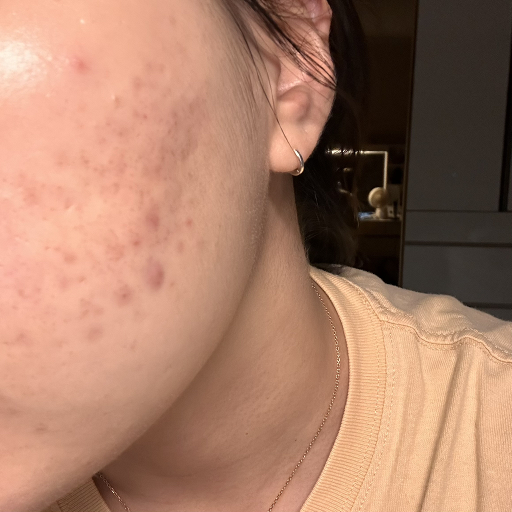 루아센시아 (Luassencia) 메디센스 캐비어 PDRN 크림 review image