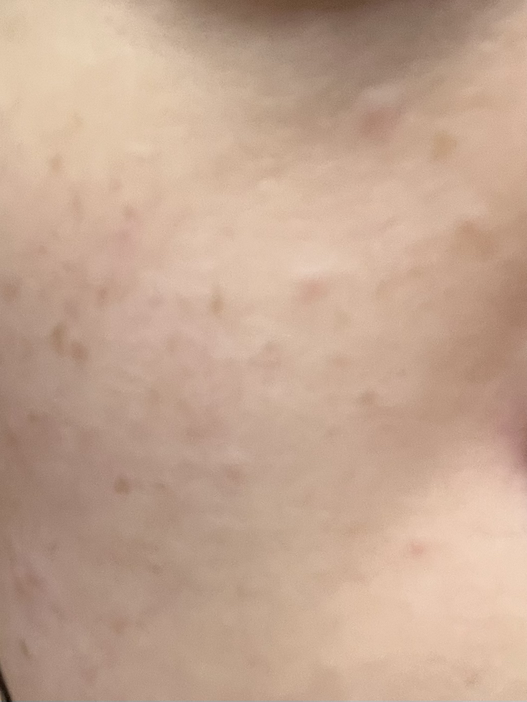 Abib Glutathione Spot Serum Vita Drop review image