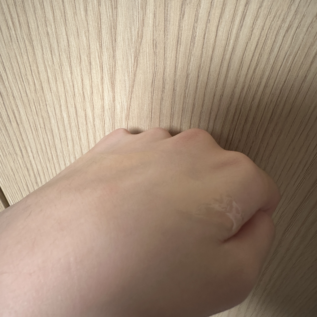 皮肤屏障 荷荷芭油的真实用户使用照片