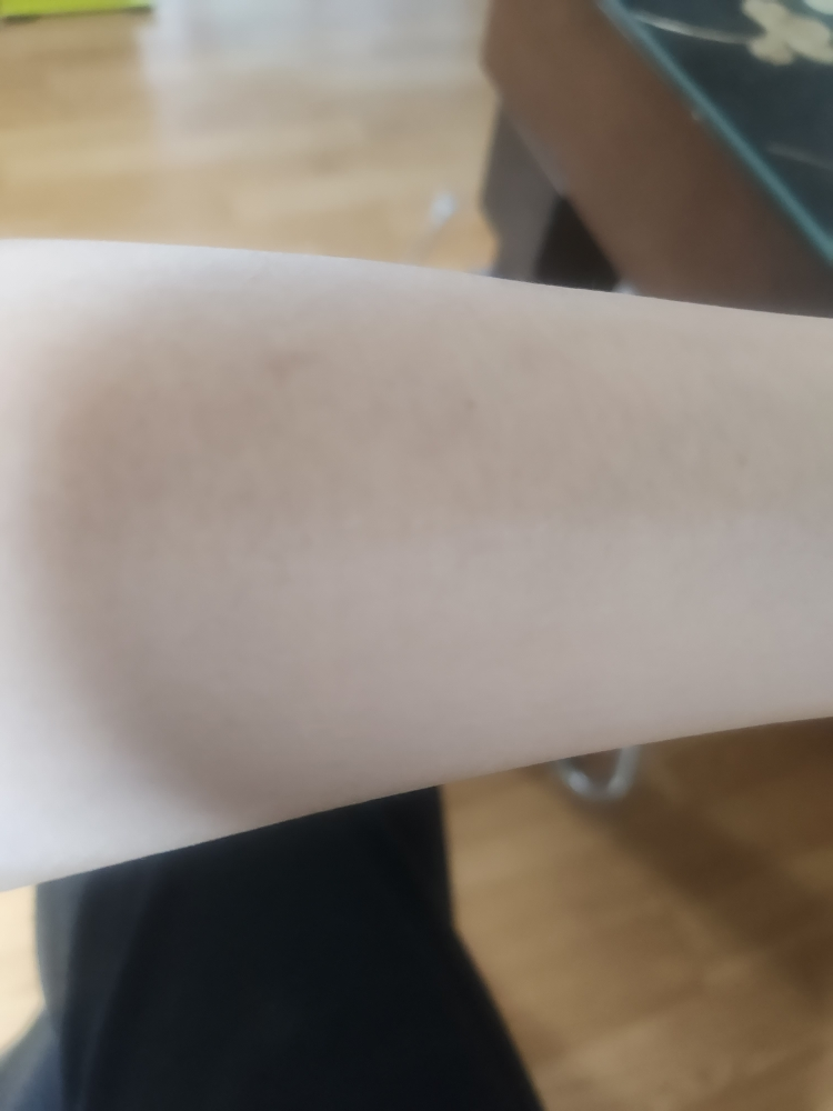 보나메두사 (bonamedusa) 오렌지 스킨 딜리트 [오리지널] review image