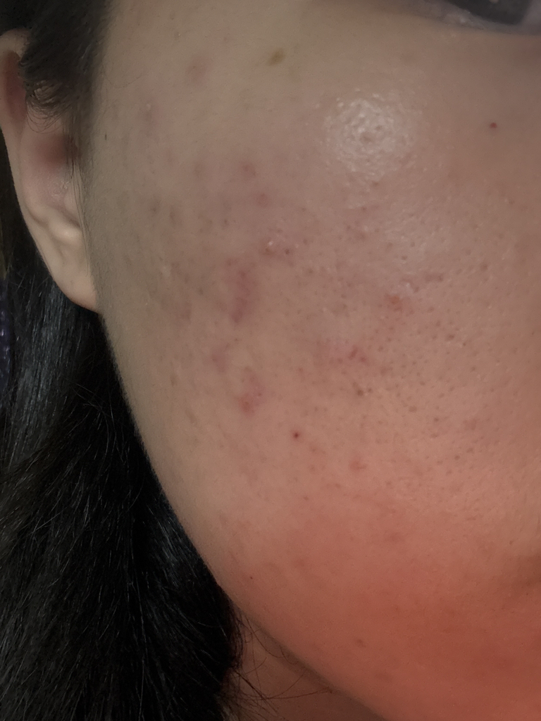 메디큐브 (medicube) 제로모공패드 2.0 review image