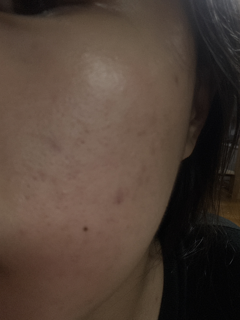 메디큐브 (medicube) 제로모공패드 2.0 review image