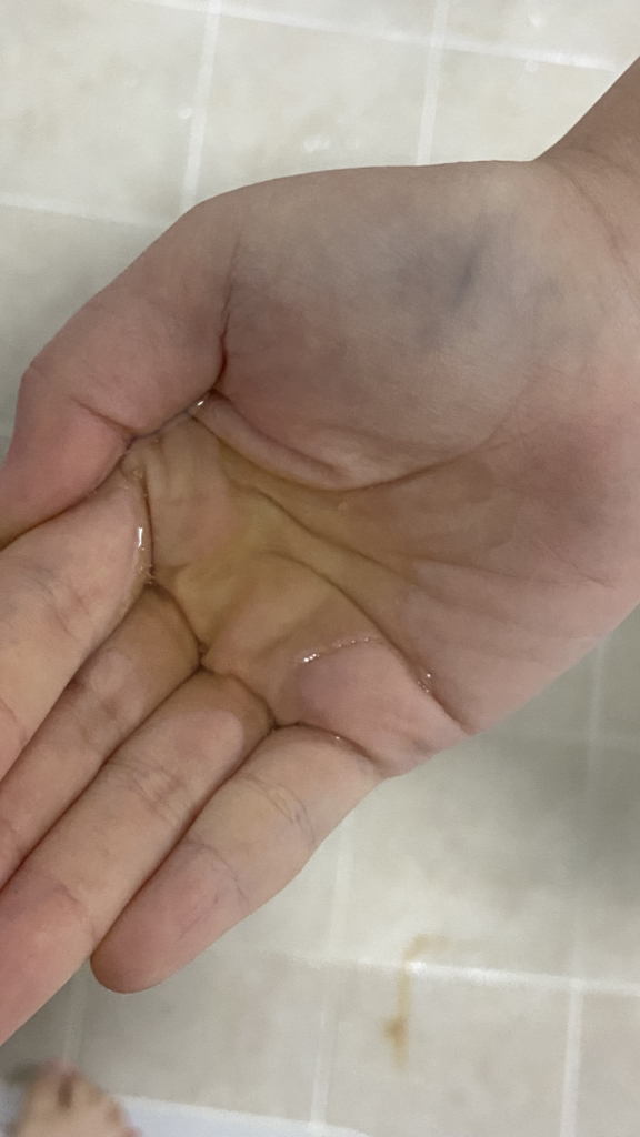 纯净洁肤油的真实用户使用照片