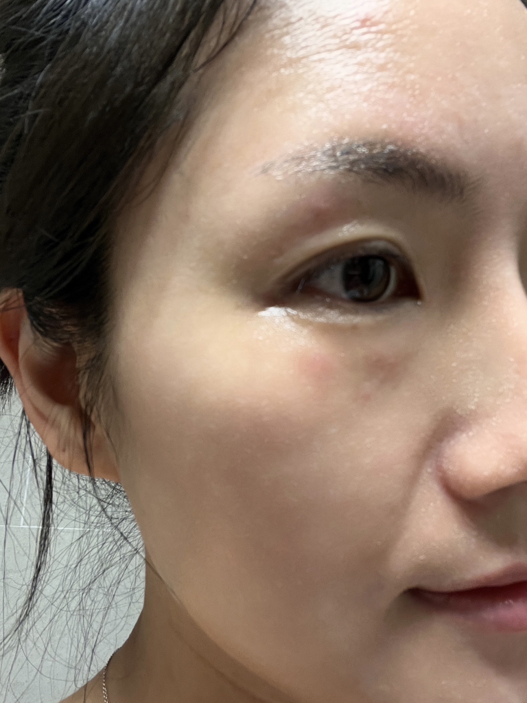 纯净洁肤油的真实用户使用照片