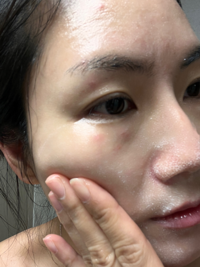 纯净洁肤油的真实用户使用照片