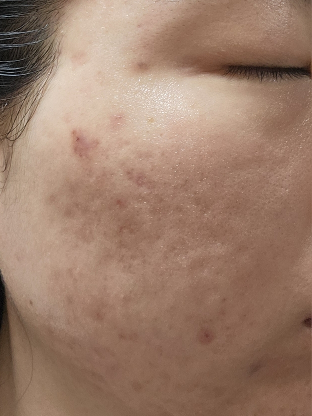 셀퓨전씨 (CellFusionC) 스킨 블레미쉬 밤 인텐시브 [내추럴 라이트] review image