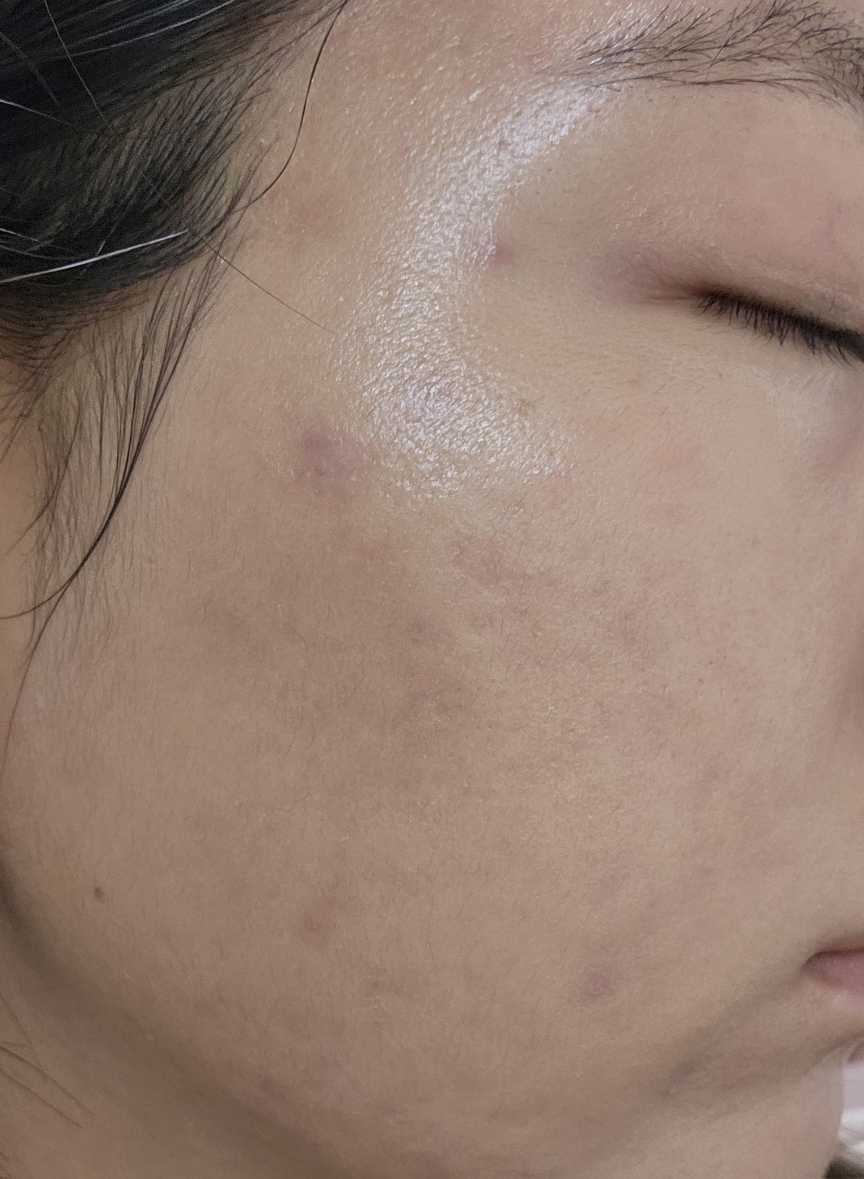 셀퓨전씨 (CellFusionC) 스킨 블레미쉬 밤 인텐시브 [내추럴 라이트] review image