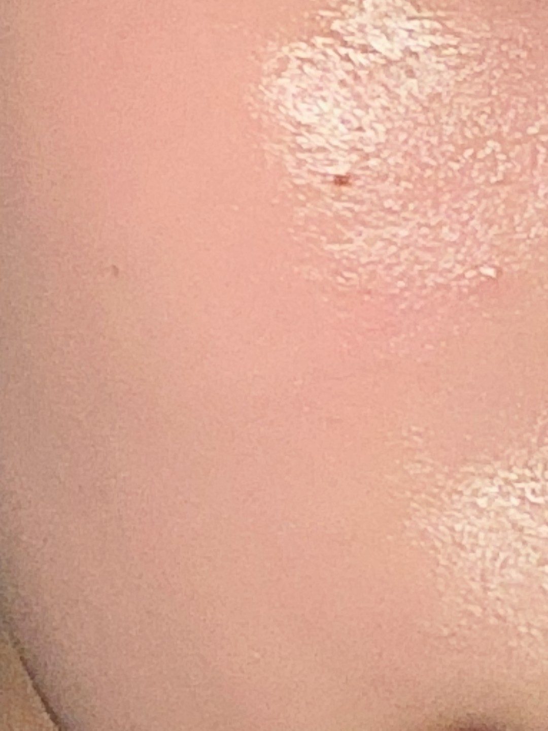 Ảnh đánh giá thực tế của người dùng về Mặt nạ thiết yếu [Tinh chất tràm trà làm dịu và dưỡng ẩm]