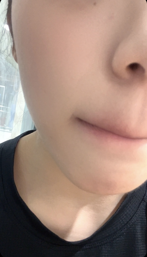 한율 (HANYUL) 보들은행잎 모공핏 세럼 review image