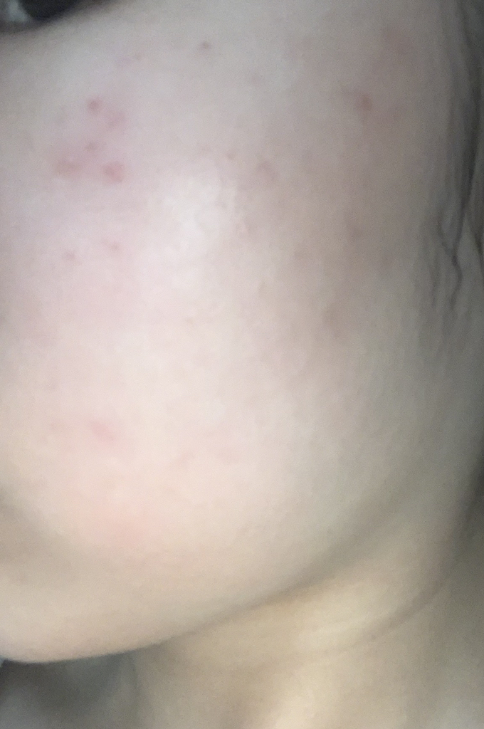 麦地卡索苷微量修复精华素的真实用户使用照片