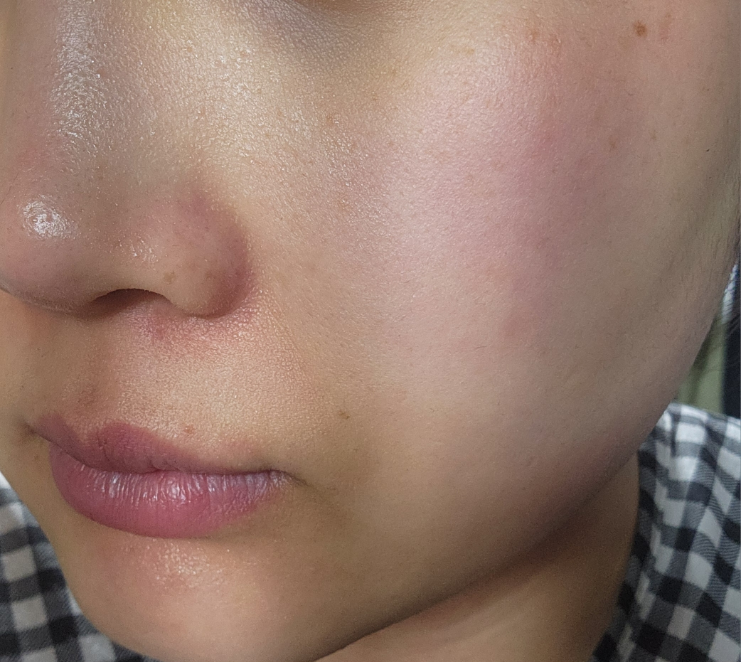 메디힐 (MEDIHEAL) 더마 모델링 팩 [마데카소사이드흔적] review image