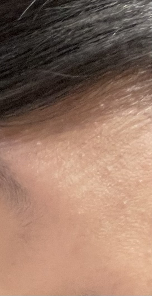 메디필 (MEDIPEEL) 물톡스 광채 보습 패드 2.0 review image