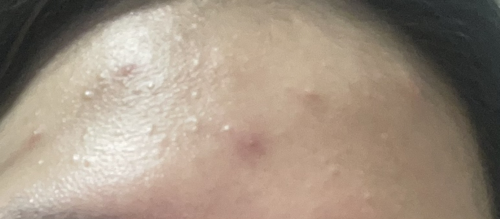 메디필 (MEDIPEEL) 물톡스 광채 보습 패드 2.0 review image