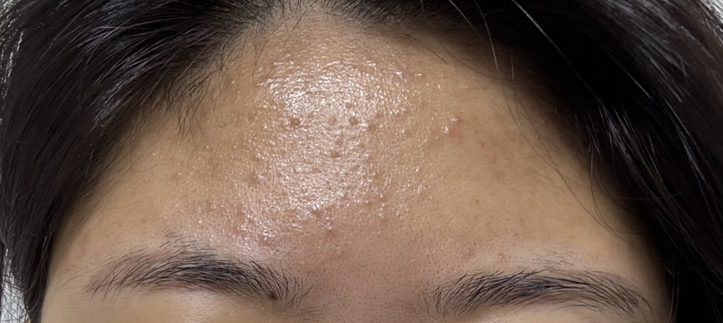 아렌시아 (ARENCIA) 라이스 LHA 딥 포어 떡솝 클렌저 review image