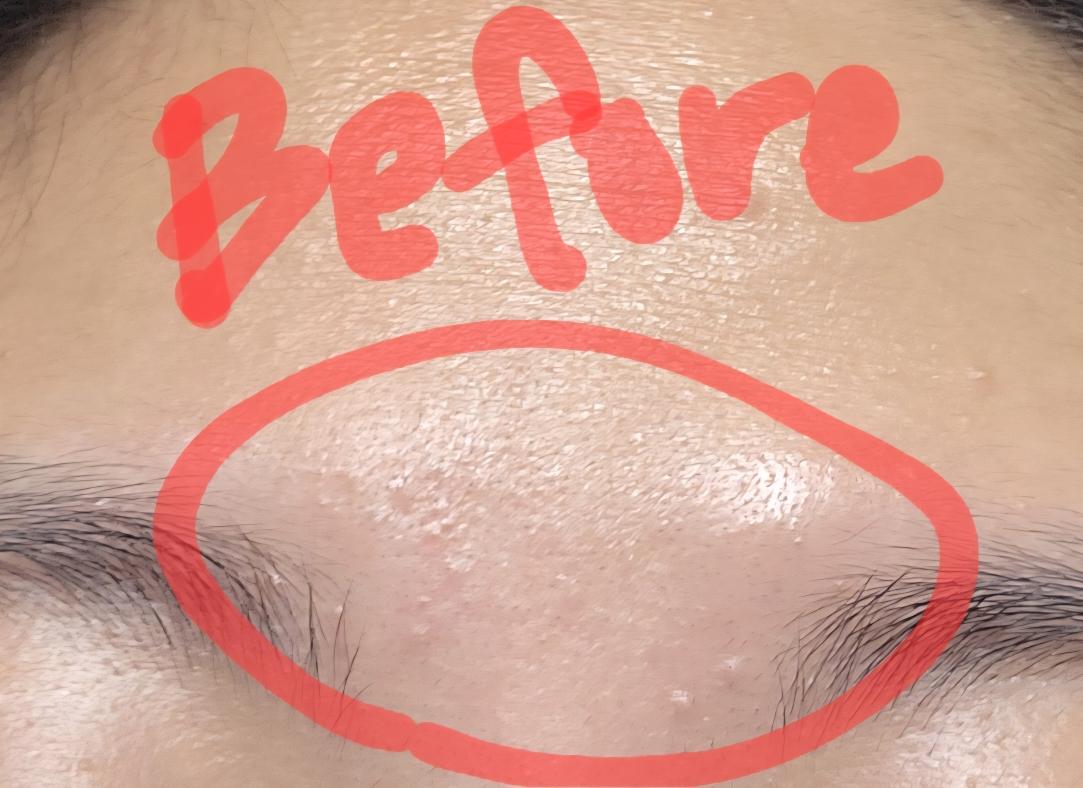 파티온 (FATION) 노스카나인 트러블 세럼 review image