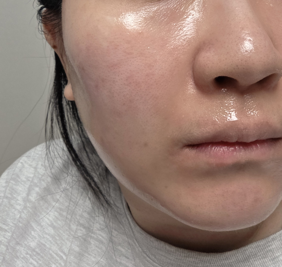 메디필 (MEDIPEEL) 엑스트라 슈퍼 9 플러스 물광 리프팅 랩핑 마스크 review image