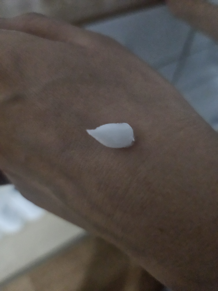 阿托贝利尔365乳霜的真实用户使用照片