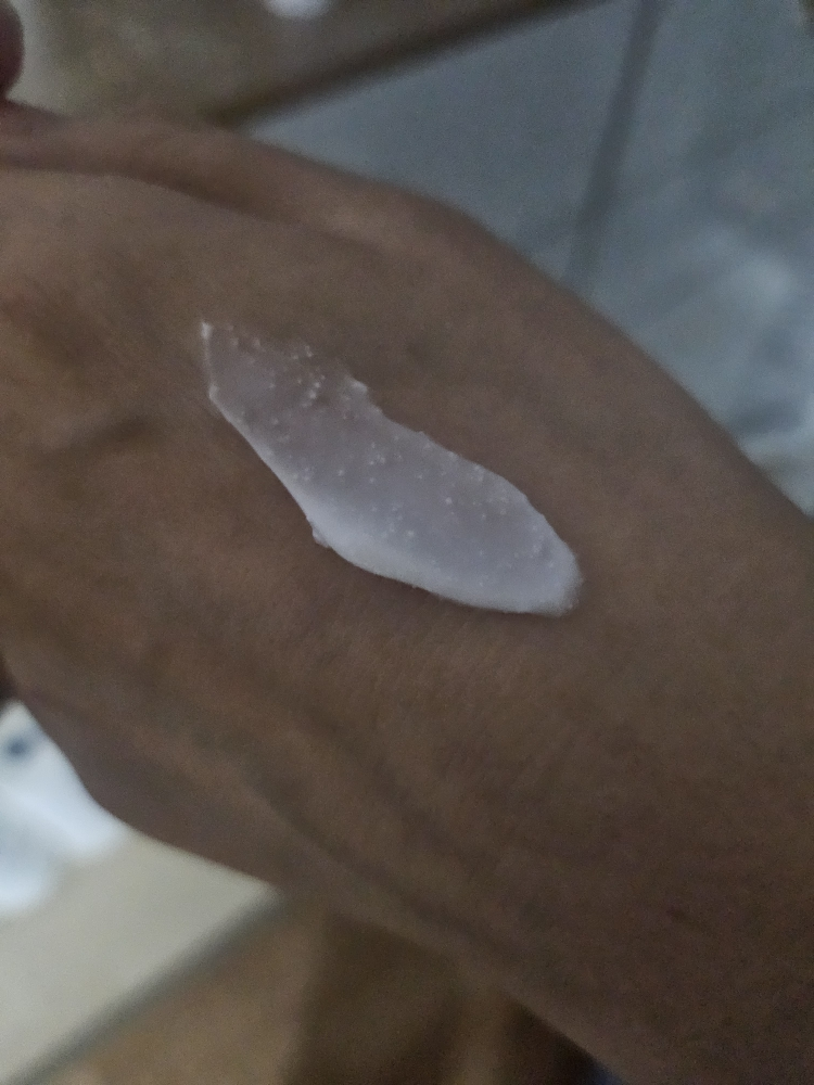 阿托贝利尔365乳霜的真实用户使用照片