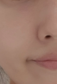 플리프 (FLEEF) 시카-알로에 밸런싱 올인원 review image