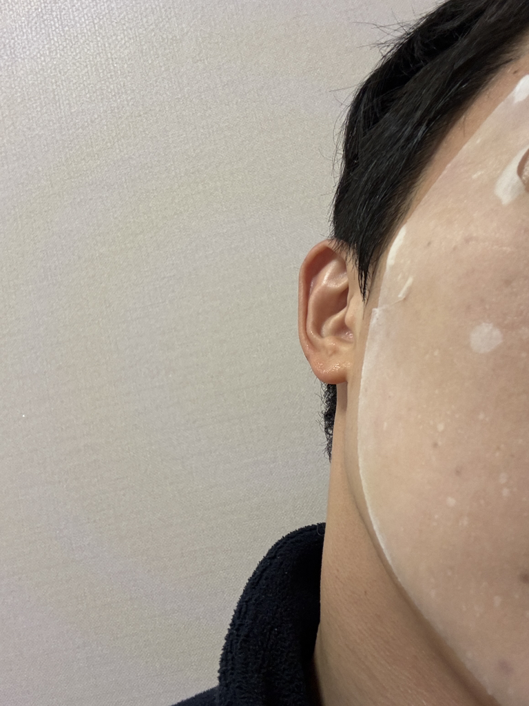 Ảnh đánh giá thực tế của người dùng về Mặt nạ thiết yếu [Tinh chất tràm trà làm dịu và dưỡng ẩm]