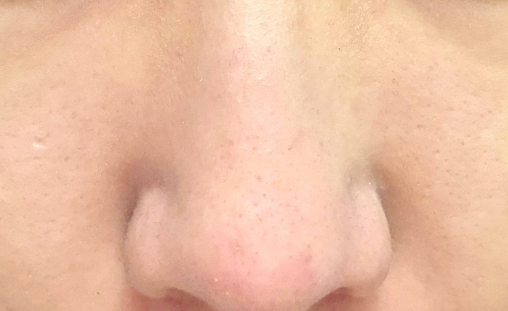 유아른 (ureun) 비건 티트리 시카 모공팩 review image