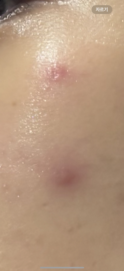 히디프 (hidiff) 로얄 판테놀 3% 카밍 세럼 review image