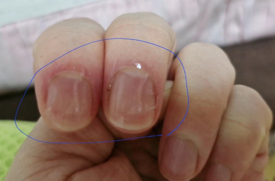 永恒之美的美甲解决方案的真实用户使用照片