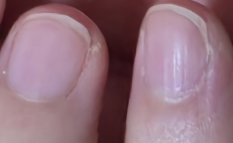 随时 永恒之美的美甲解决方案 common.review image