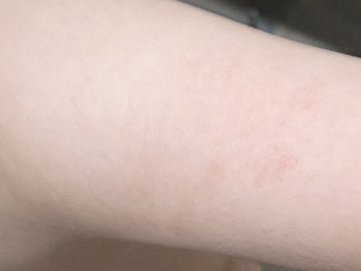 아토팜 (ATOPALM) 릴렉싱 나이트 밤 review image