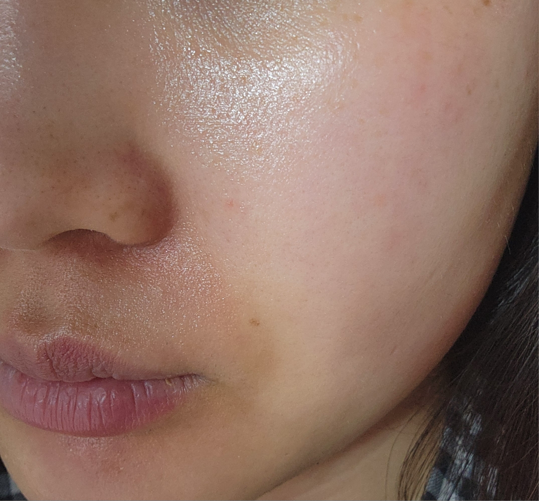 Ảnh đánh giá thực tế của người dùng về Kem trị mụn North Canine