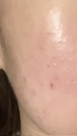 Ảnh đánh giá thực tế của người dùng về Pine Calming Shika Ampoule