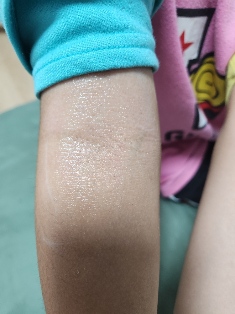 몽디에스 (mongdies) 아토 로션 review image