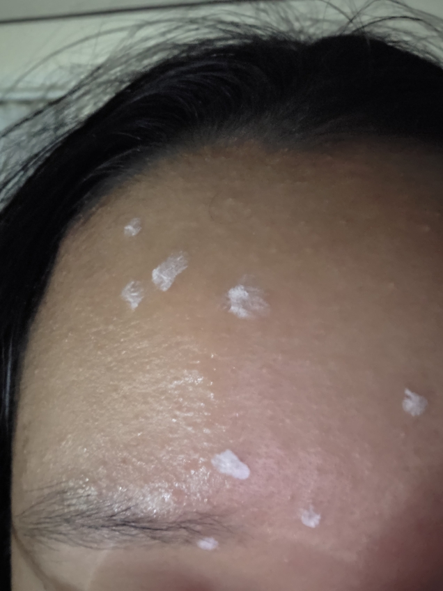 asolution Eoseongcho Calamine Soothing Spot review image