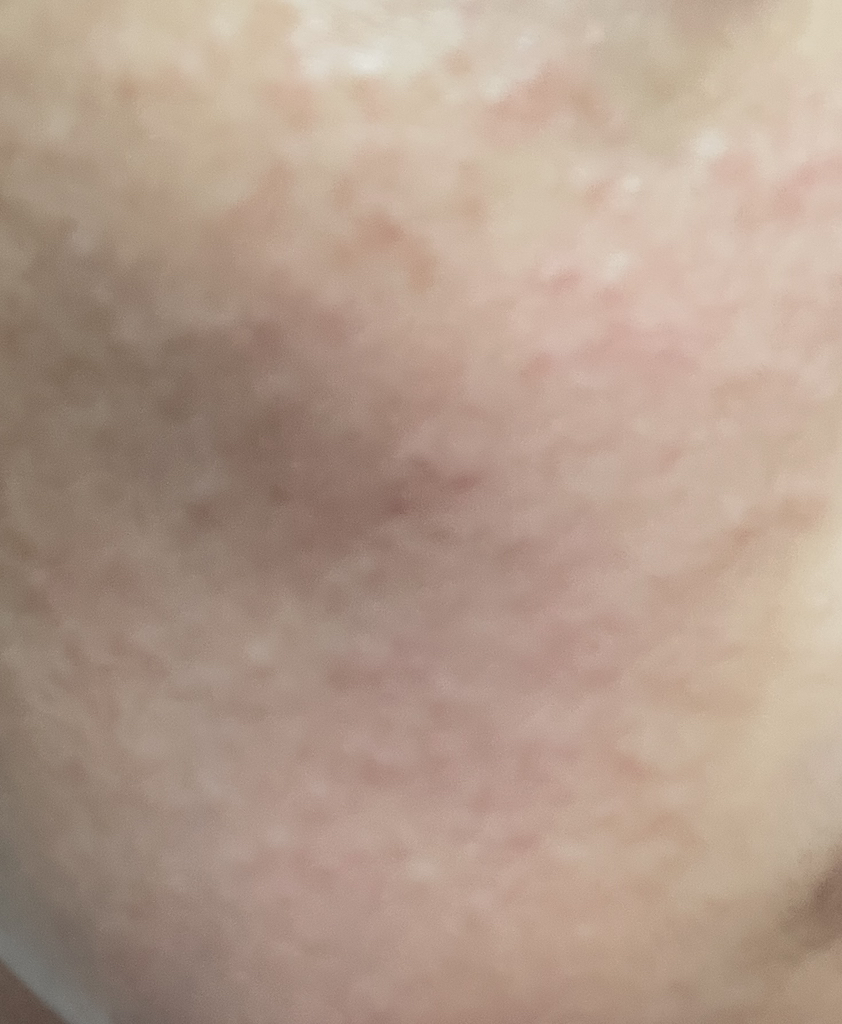 앰플엔 (AMPLE:N) 앰플 [펩타이드샷] review image