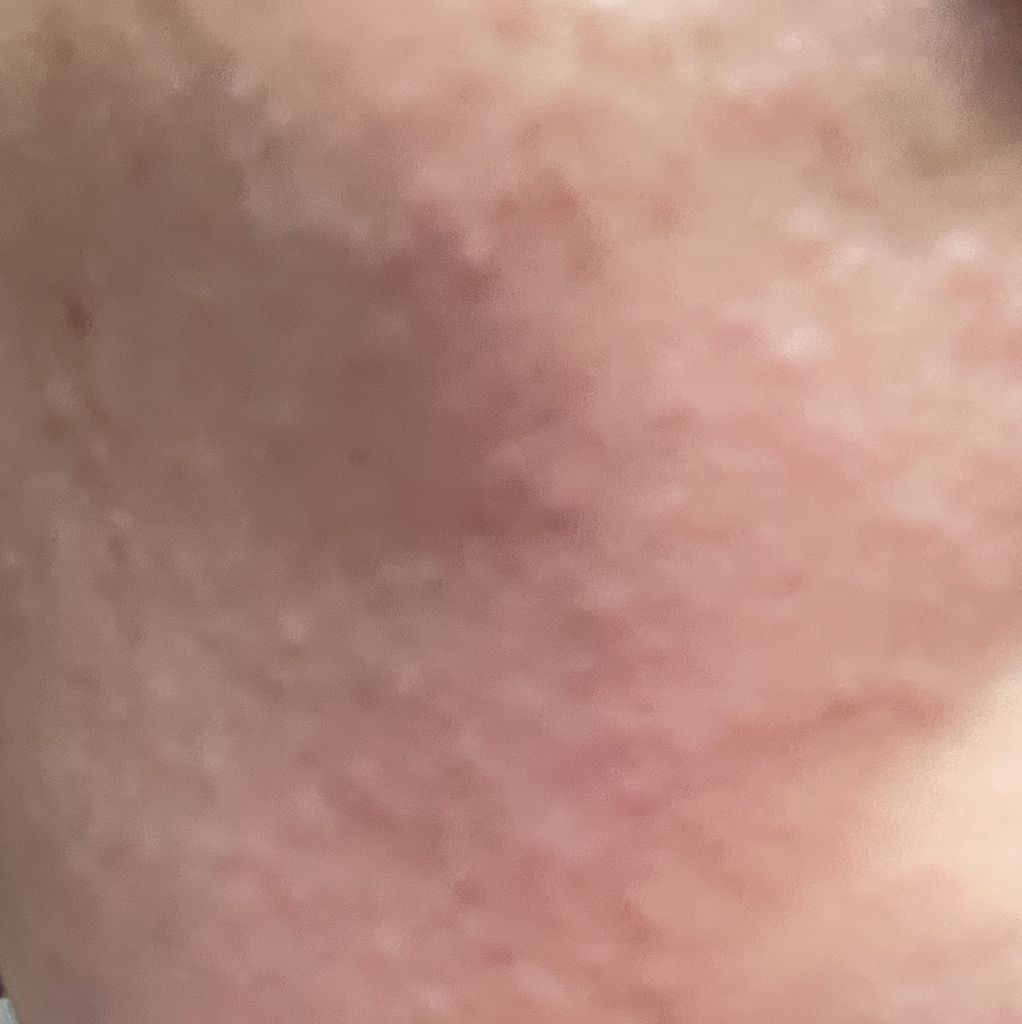 앰플엔 (AMPLE:N) 앰플 [펩타이드샷] review image