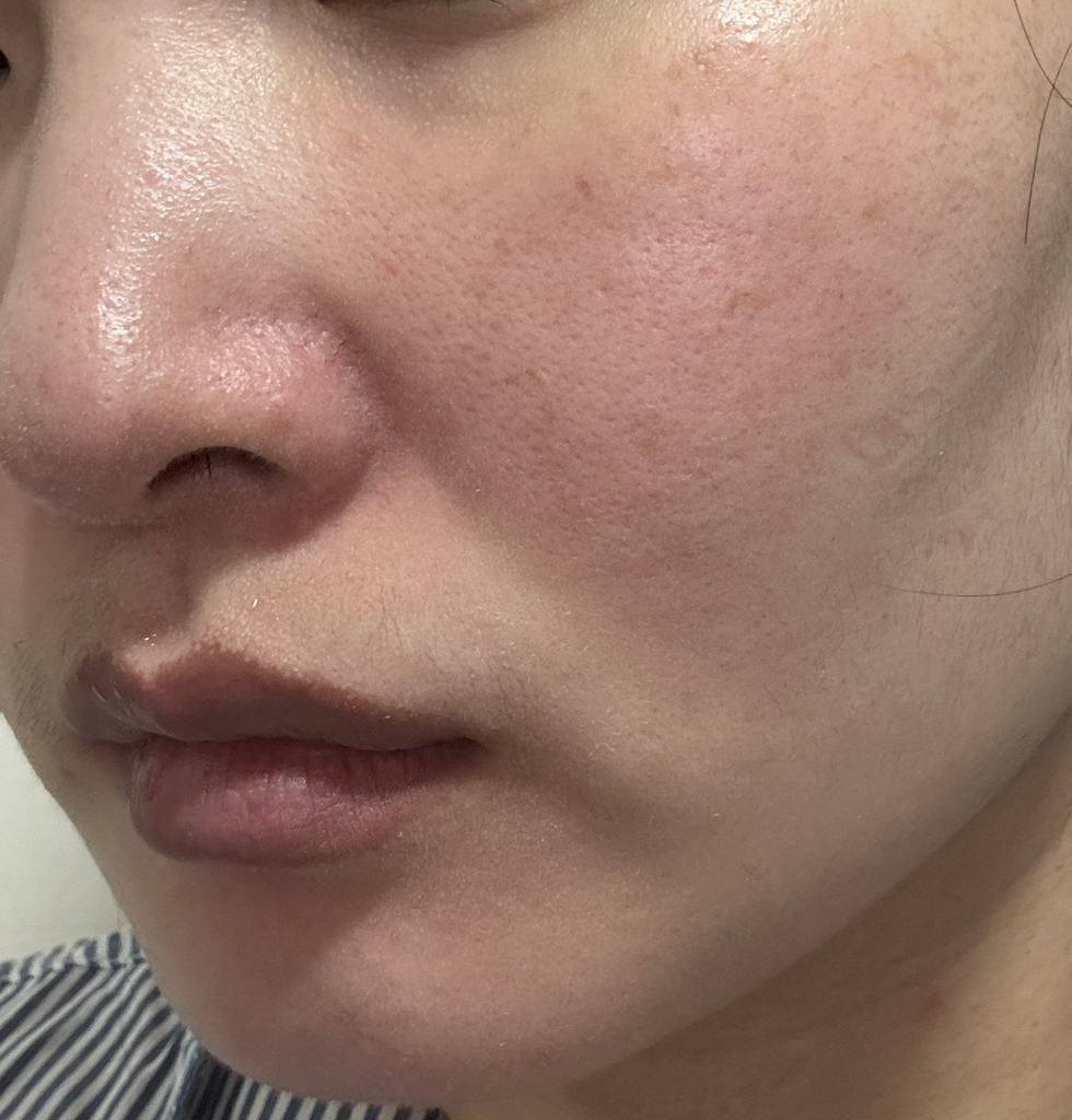 밀바랩 (MilbaLab) 제주 용암해수 보습 앰플 에센스 review image