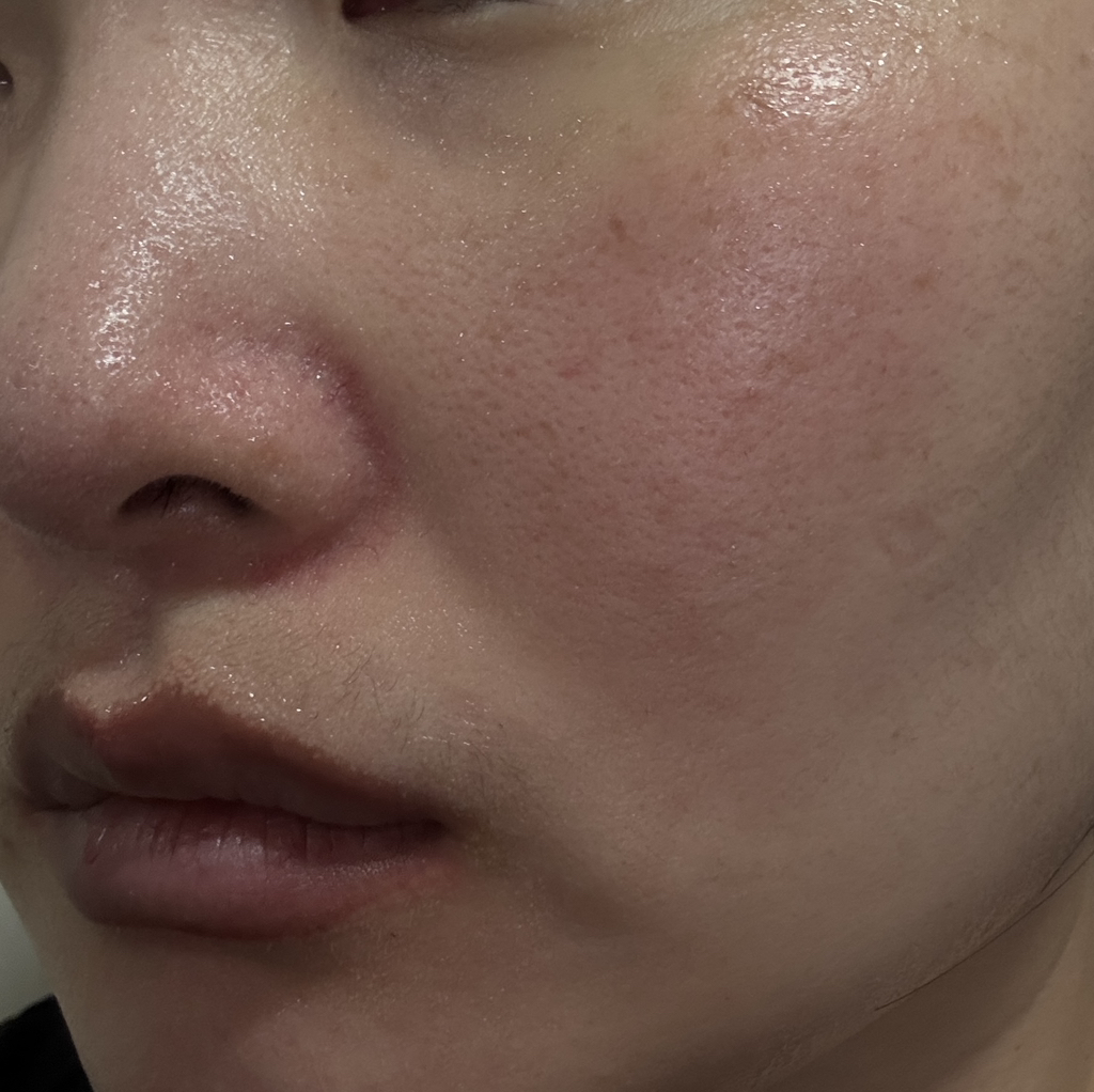 밀바랩 (MilbaLab) 제주 용암해수 보습 앰플 에센스 review image