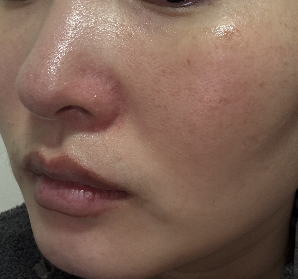 밀바랩 (MilbaLab) 제주 용암해수 보습 앰플 에센스 review image