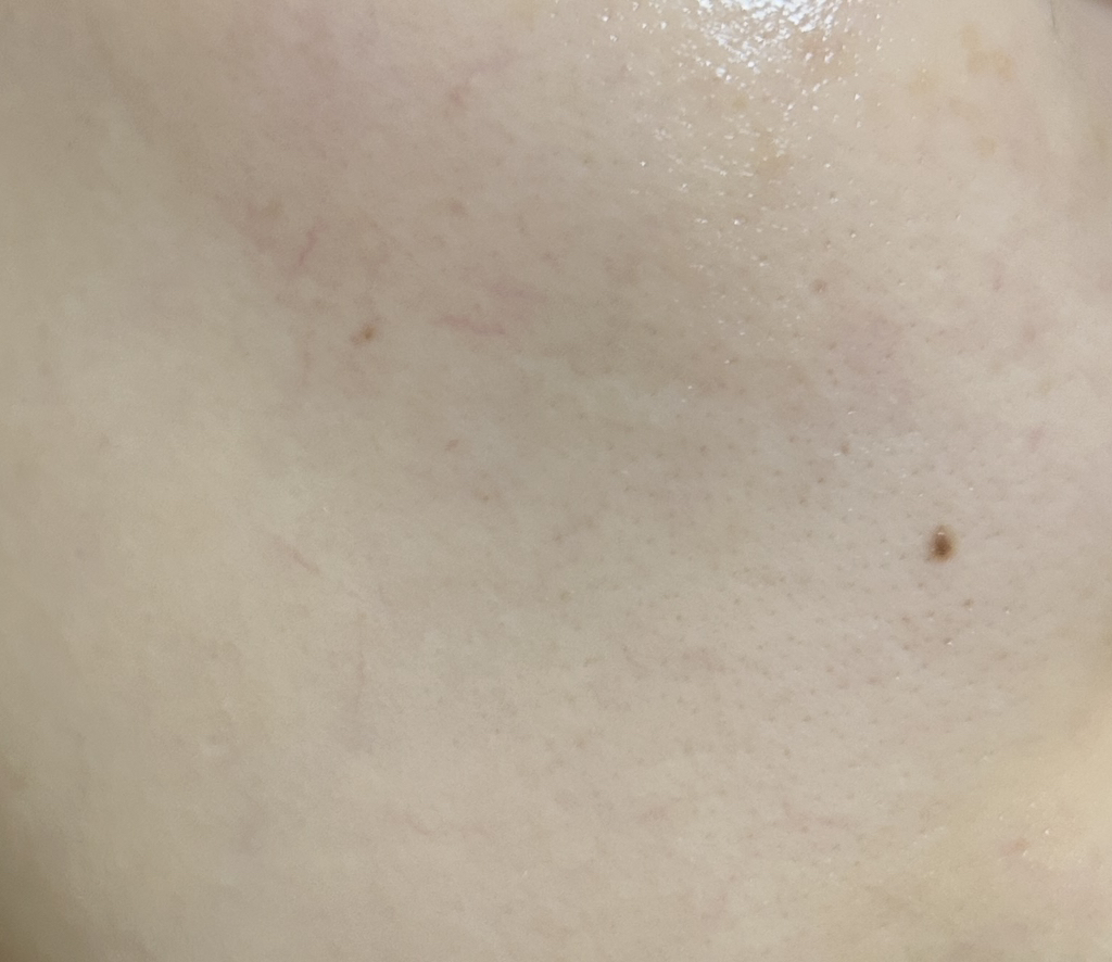 엘라비에코스메틱 (elraviecosmetic) 하이시카뮤 앰플 review image