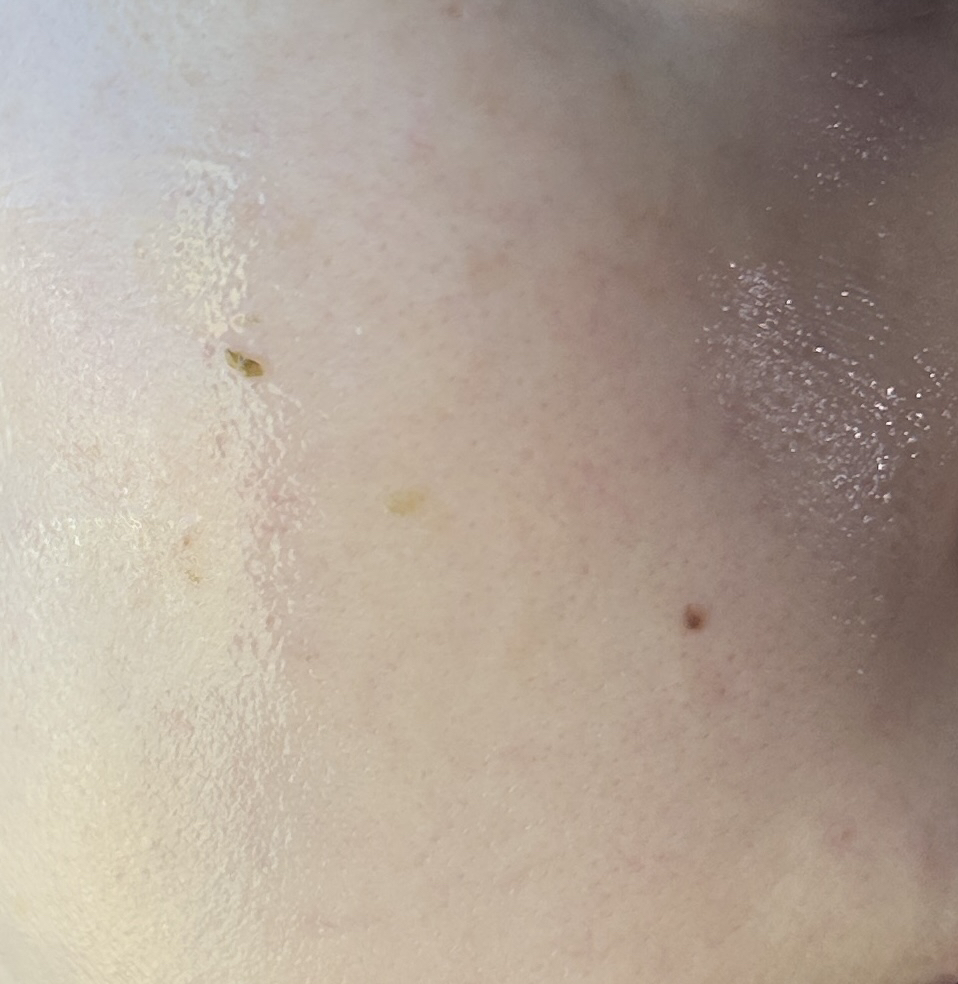 엘라비에코스메틱 (elraviecosmetic) 하이시카뮤 앰플 review image