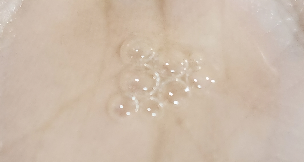 Ảnh đánh giá thực tế của người dùng về PDRN 5% Active Ampoule