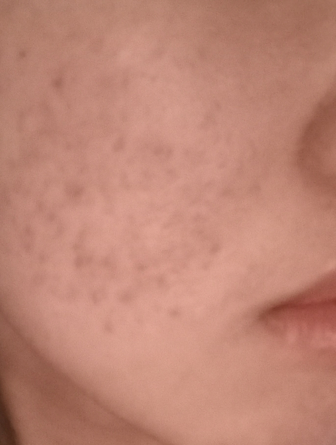 ILLIYOON Kem dưỡng ẩm Hyaluron Moisture review image