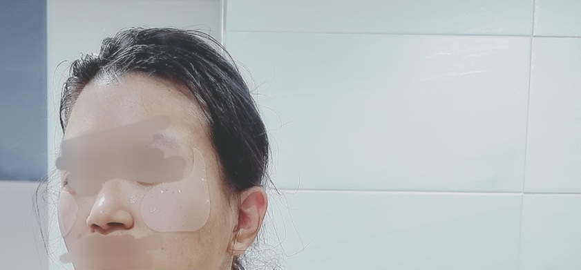MEDIHEAL Collagen Capsule Patch [Retinol] review image
